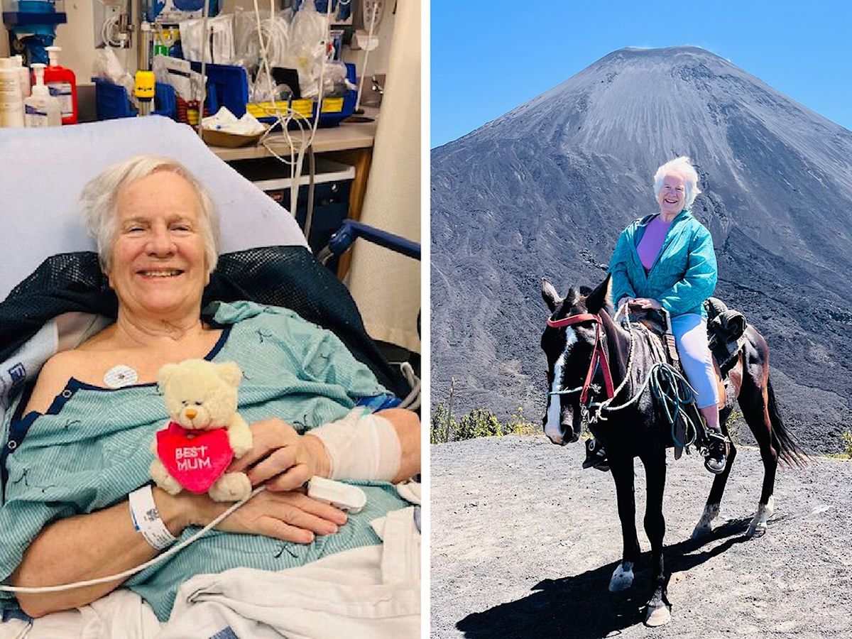Miriam Lancaster in hospital after her fracture in 2025 (left), and on Guatemala's Pacaya volcano after her recovery (right).